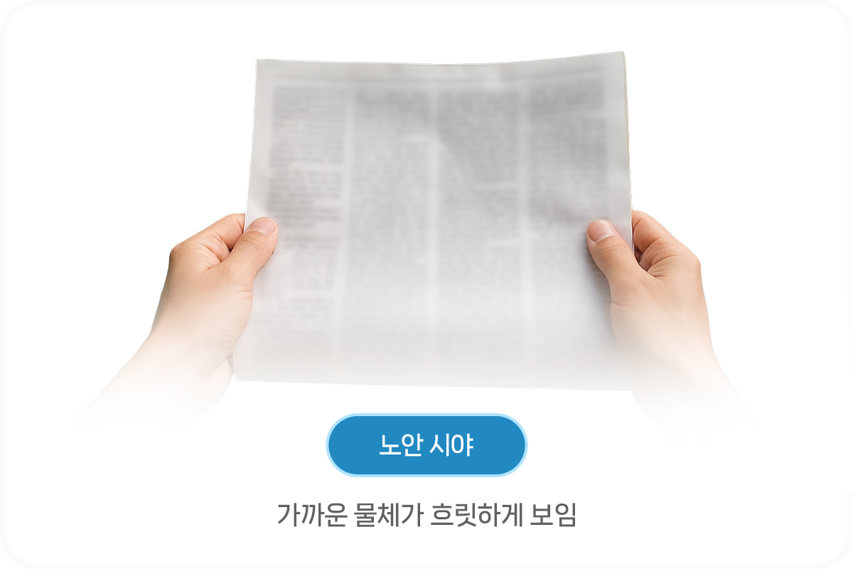 노안 백내장 차이점_ 노안 시야