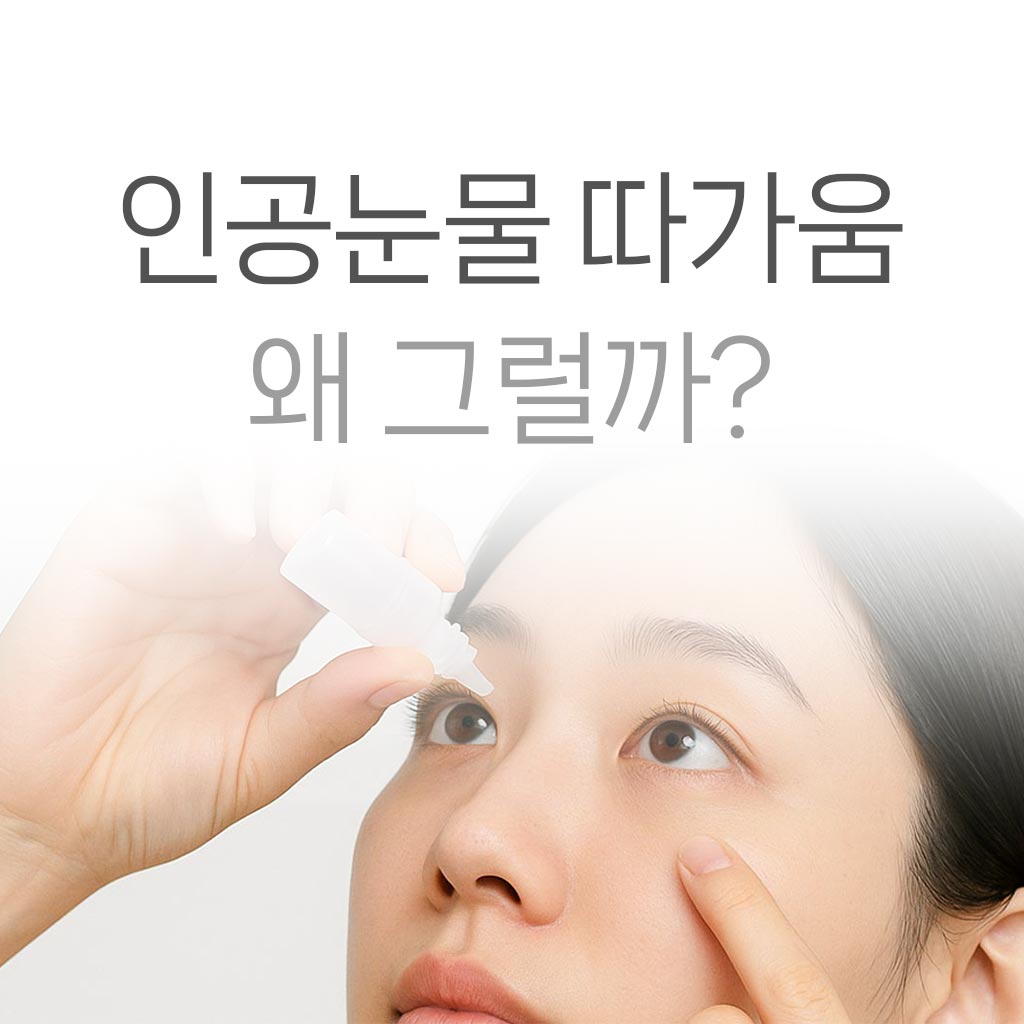 안구건조증 인공눈물 따가움
